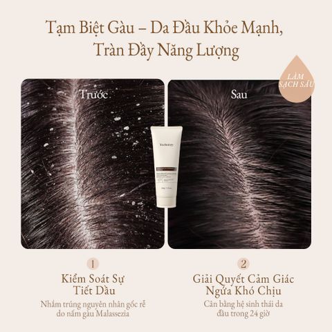 Youthology Gội Ngừa Gàu 200g – Kiểm Soát Dầu, Thơm Lâu, Da Đầu Sạch Khỏe