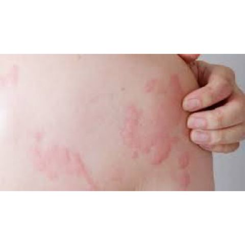Cà gai leo Pubic Health phục hồi chức năng gan kém(Hộp 60viên)