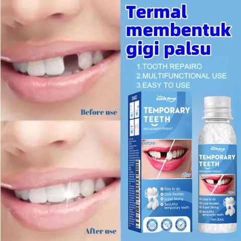 Keo Nhựa Răng Sửa Chữa Định Hình Răng, Keo Lắp Đầy Khoảng Trống Răng, Tạm Thời Sửa Chữa Răng Giả Keo An Toàn