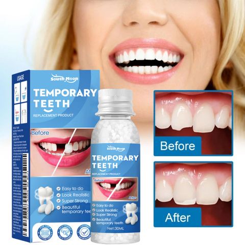 Keo Nhựa Răng Sửa Chữa Định Hình Răng, Keo Lắp Đầy Khoảng Trống Răng, Tạm Thời Sửa Chữa Răng Giả Keo An Toàn