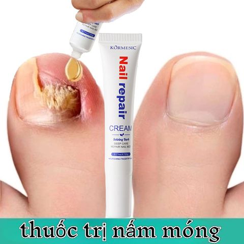 Serum Nấm Móng Tay Chân Hết Sạch Nấm, Bọng Móng, Hư Khoé, Nước Ăn Tay Chân, Dưỡng Cứng Móng