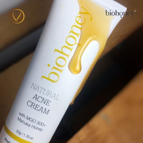 Kem loại bỏ mụn, giảm thâm mụn mật ong manuka Biohoney Natural Acne Cream 50g