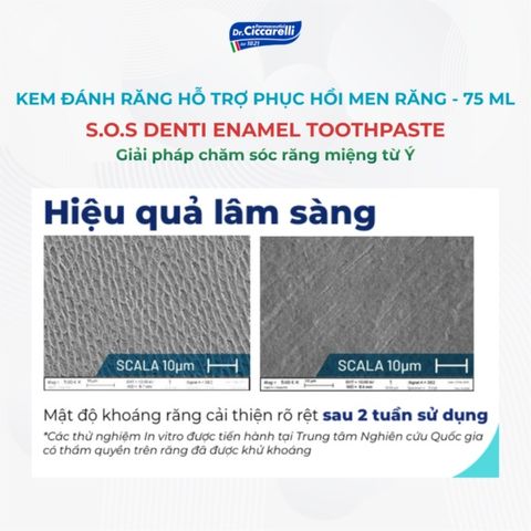 Kem đánh răng trắng răng, loại bỏ mảng bám Dr Ciccarelli S.O.S DENTI Whiteness Toothpaste 75 ml
