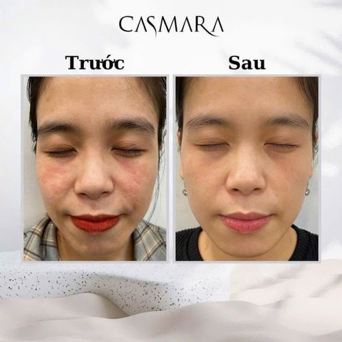 Kem phục hồi và bảo vệ da 360 Casmara Age Defense Cream 360 chai 50ml