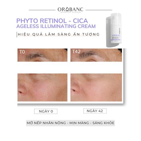 Kem dưỡng trẻ hóa, căng bóng da | PHYTO RETINOL - CICA AGELESS ILLUMINATING CREAM OROBANC