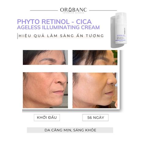 Kem dưỡng trẻ hóa, căng bóng da | PHYTO RETINOL - CICA AGELESS ILLUMINATING CREAM OROBANC