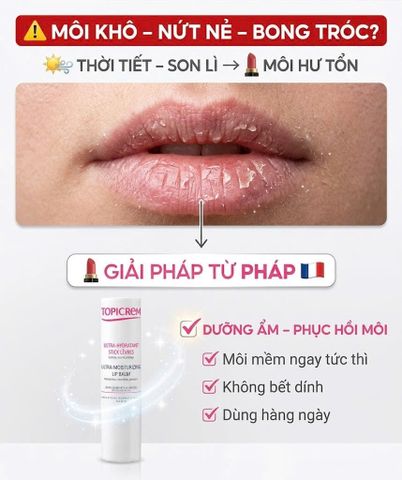Topicrem Ultra Hydratant Stick Lèvres Son Dưỡng Môi Dưỡng Ẩm Phục Hồi Môi Khô Nứt Nẻ