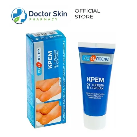 Kem Kpem Giảm Và Phục Hồi Nứt Nẻ Gót Chân Kpem 50ml xuất xứ Nga