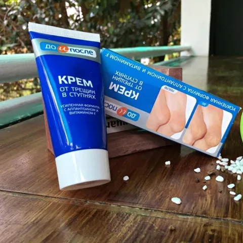 Kem Kpem Giảm Và Phục Hồi Nứt Nẻ Gót Chân Kpem 50ml xuất xứ Nga