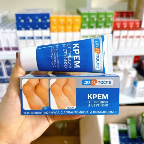 Kem Kpem Giảm Và Phục Hồi Nứt Nẻ Gót Chân Kpem 50ml xuất xứ Nga