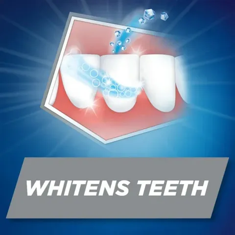 Kem Đánh Răng Aquafresh của Nga giúp Đánh Bay Mảng Bám Dưỡng Nướu Chắc Khỏe Hơi Thở Thơm Mát