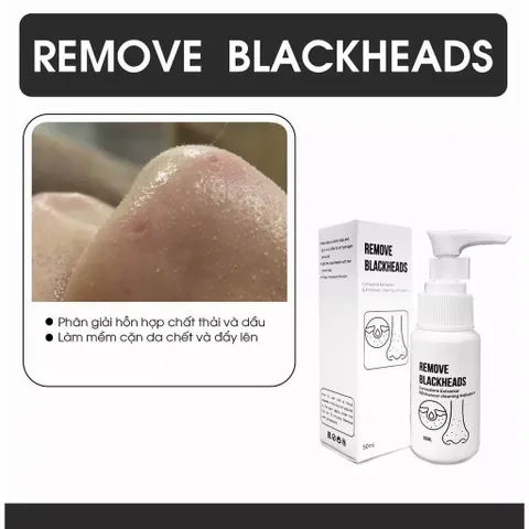 Ủ mụn đầu đen Removes BlackHeads dung tích 50ml