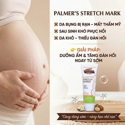 Kem rạn da Palmer's Cocoa Butter Formula Massage Cream Stretch Marks 125g
