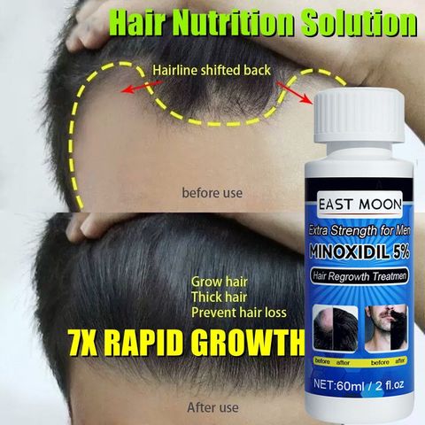 Dung dịch làm dày tóc Minoxidil 5% (60ml/chai)Dầu râu mọc tóc mọc tóc để Hair Growth