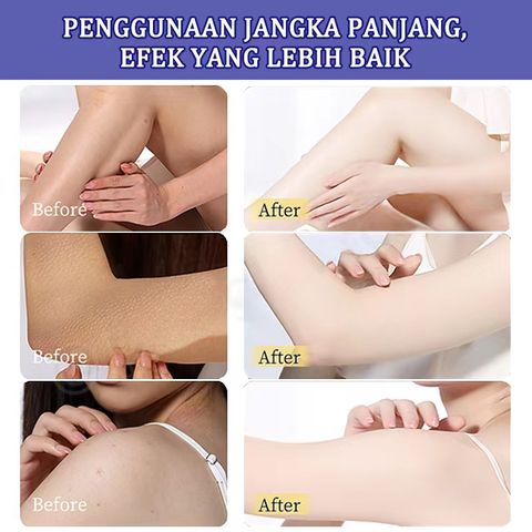 Kem dưỡng ẩm vitamin E kết hợp Hoa Anh Thảo 400ML