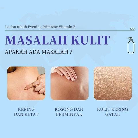 Kem dưỡng ẩm vitamin E kết hợp Hoa Anh Thảo 400ML