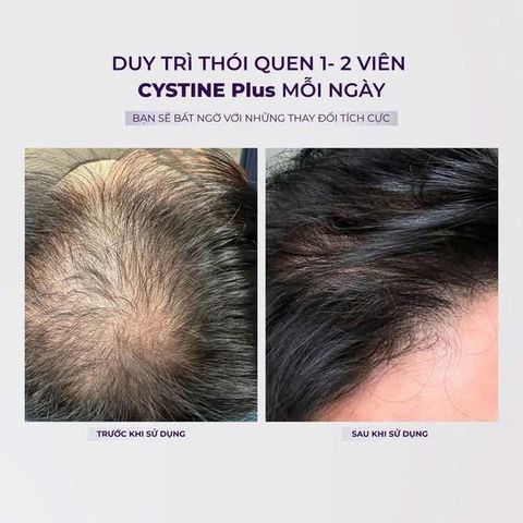 CYSTINE Plus –Hỗ trợ hình thành keratin cho mái tóc chắc khỏe, da sáng mịn  khỏe đẹp tự nhiên (60 viên)