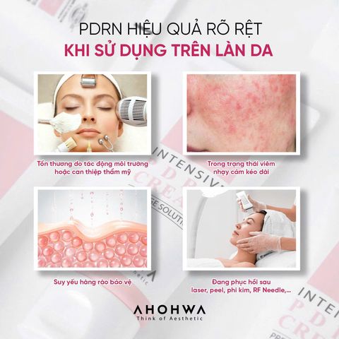 AHOHWA PDRN CREAM – KEM PHỤC HỒI ĐA TẦNG, TÁI TẠO DA TỪ GỐC 50G