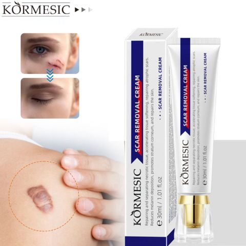 Kem XóA SẹO ThâM SẹO PhẫU ThuậT LồI LõM Rỗ Mờ ThâM MụN RạN Da NgừA MụN Kem Mờ SẹO LâU NăM Kem LàM Mờ SẹO ThâM