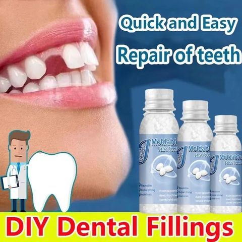 Keo dán răng Nhựa Nha Khoa Tạm Thời Bộ Dụng Cụ Sửa Chữa Răng Và Khoảng Cách Răng Giả Tiện Dụng