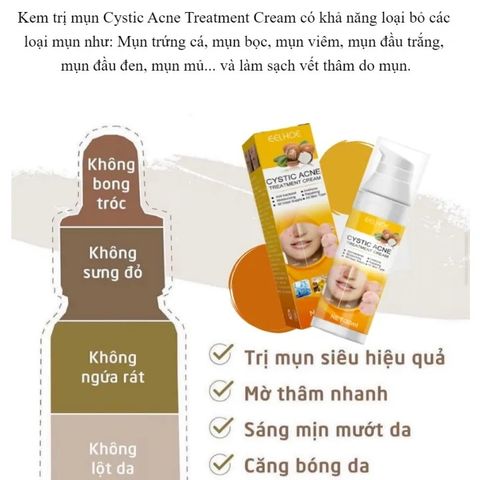 Kem Giảm Mụn Cấp Tốc Loại Bỏ Mụn và Vết Thâm Hoàn ToànThu Nhỏ Lỗ Chân Lông CYSTIC Acne Giúp DaLáng Mịn Khít Lỗ Chân Lông