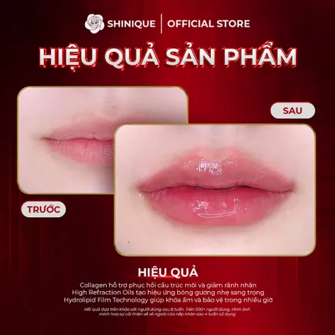SHINIQUE Collagen Lip Balm 9g - Son Dưỡng Môi Collagen Kết Hợp Vitamin Giúp Phục Hồi, Giữ Ẩm và Bảo Vệ Môi Suốt 24h