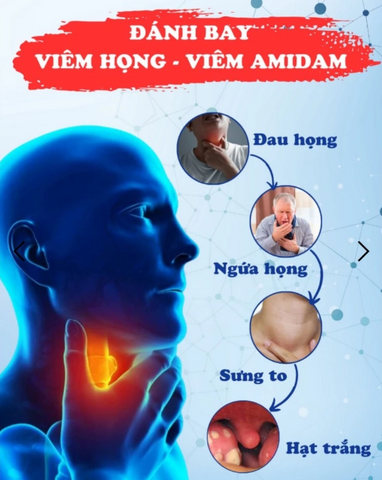 GEL NHẬT BẢN Giảm Viêm Họng,Giảm Đau Rát  chăm sóc vùng cổ họng SENKO Nhật Bản 20g - Gel Mỡ SENKO Dịu Họng Nano Cổ Truyền