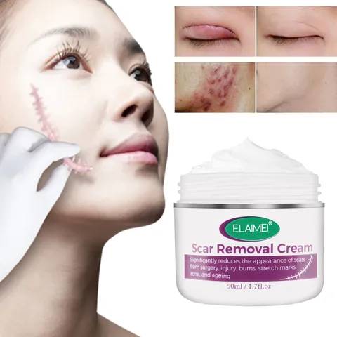Kem Làm Mờ Sẹo OUHOE 
