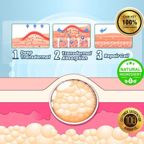 8 Miếng Cao Dán Tan U Bướu Mỡ, Tan Mỡ Bắp Tay, Mỡ Bụng,...Tinh Chất Thảoo dượcc Tự nhiên 100% - SIÊU RẺ