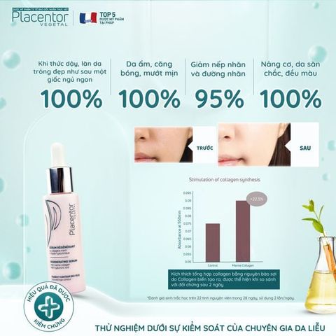 Tinh Chất Dưỡng Ẩm Và Giảm Nếp Nhăn Placentor Vegetal Serum Regenerant Regenerating Serum