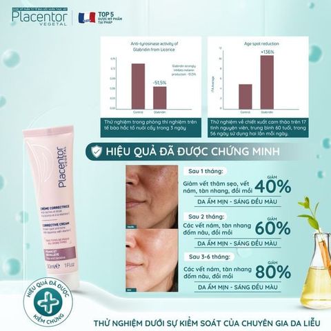 Kem Dưỡng Ẩm, Hỗ Trợ Làm Mờ Nám Placentor Vegetal Creme Correctrice Corrective Cream