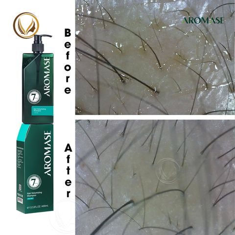 Dầu gội làm phồng tóc, ngăn rụng và giúp mọc tóc AROMASE Hair Volumizing Shampoo 400ml