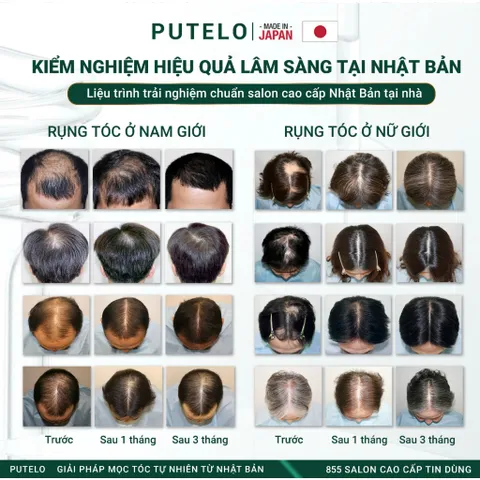 Tinh chất dưỡng da đầu, hỗ trợ mọc tóc, giảm rụng – Putelo AR Essence Plus 140ml-Chính hãng Nhật Bản