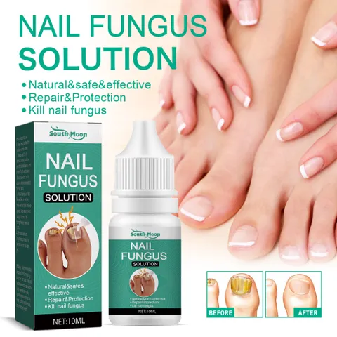 Serum loại bỏ nấm móng Tinh chất phục hồi móng 10ml Serum phục hồi móng Móng kháng khuẩn chân loại nấm móng gãy
