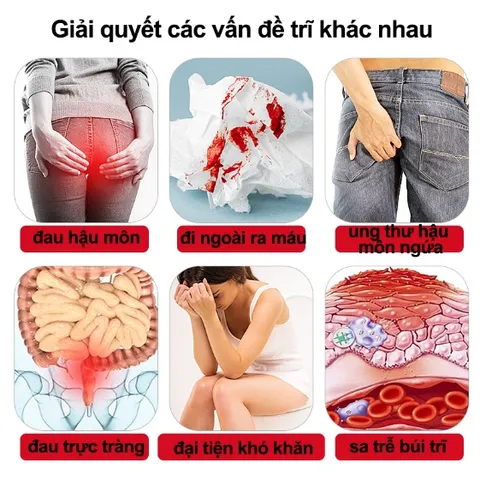 Nhật Bản Kem bôi trĩ gel bôi trĩ Loại bỏ Trĩ hỗn hợp trĩ nội trĩ ngoại ngứa ra máu nứt hậu môn Giảm sưng 20g
