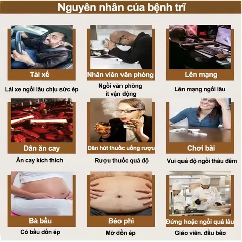 Nhật Bản Kem bôi trĩ gel bôi trĩ Loại bỏ Trĩ hỗn hợp trĩ nội trĩ ngoại ngứa ra máu nứt hậu môn Giảm sưng 20g