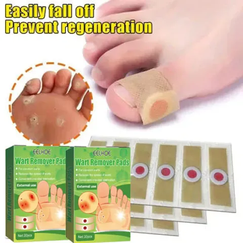 Miếng dán plasters (Hộp 30 miếng Plaster - Tem chống hàng giả) Xử lý Mụn cóc, Mắt cá chân, Vết chai, Cồi cá, Mụn hạt