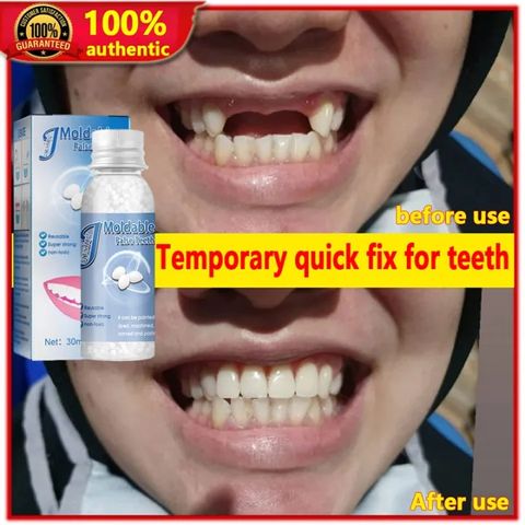 Keo dán răng Nhựa Nha Khoa Tạm Thời, Cứng, Keo Dán Răng Giả, Đạo Cụ Răng Giả Dính Tạm Thời Chứa Đồ Trang Trí Tiệc Tùn