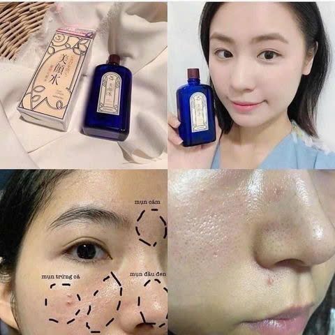 Toner Meishoku Nhật Bản 90ml – Kiểm Soát Dầu, Se Khít Lỗ Chân Lông, Da Sạch Thoáng