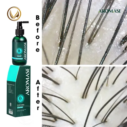 Xịt dưỡng tóc, làm dịu và giảm viêm da đầu AROMASE Herbal Cooling Scalp Care Spray 40ml - cho da dầu