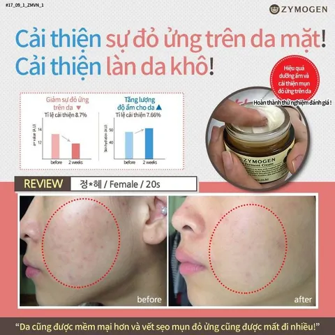 Kem Rau Má Zymogen Centella Ferment Cream Rau Má Lên Men Dưỡng Da Ngừa Mụn, Tái Tạo Da, Mờ Thâm, Lành Sẹo 50ml