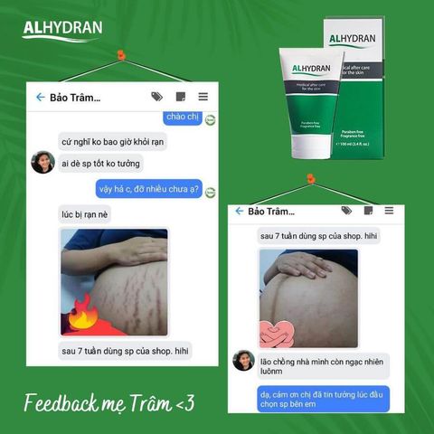 Kem Dưỡng Ẩm ALHYDRAN - Phục Hồi, Tái Tạo Da Hư Tổn, Nhạy Cảm, An Toàn Cho Bà Bầu, Phụ Nữ Mang Thai 30ml