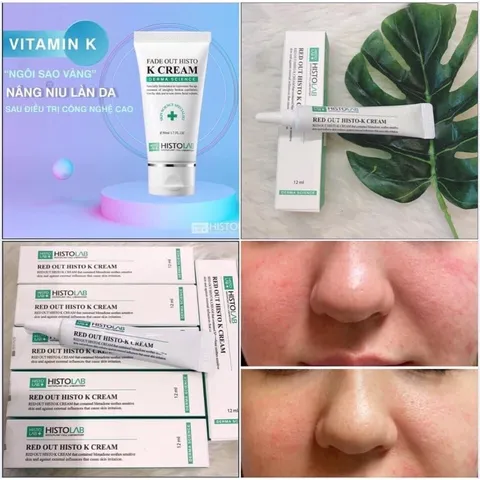 [HÀNG CÔNG TY] Kem Dưỡng Histolab Red Out Histo K Cream Tái Tạo Da Sau Liệu Trình Giảm Vết Đỏ Bầm Cải Thiện Đốm Nâu