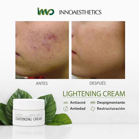 HÀNG CÔNG TY -Kem Inno Peel A Hoạt Chất Vitamin A 5% Innoaesthetics Inno LIGHTENING Tái Tạo Đều Màu Da Giảm Mụn Thâm Mụn
