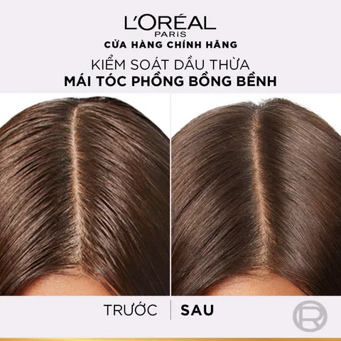 Bộ Gội Xả L’Oréal Paris Elseve Hyaluron 72H Pure/Moist 620ml 375ml - Tóc Mềm Mượt Nhẹ Bồng 720780