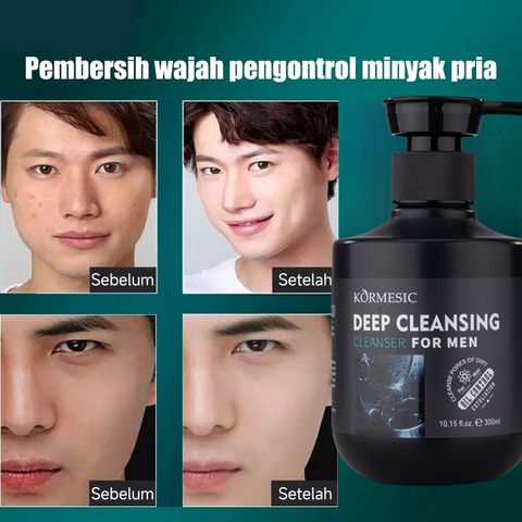 Sữa rửa mặt cho nam sạch dầu nhờn ngừa mụn Men Stay Simplicity Facial Cleanser 300ml