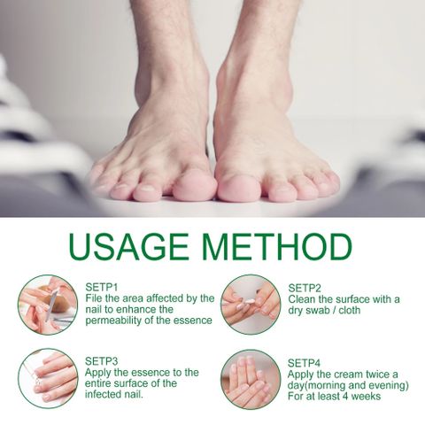 Nấm móng tay Loại bỏ nguyên nhân gốc rễ của nấm Sửa chữaa móng tay bị hư hỏng