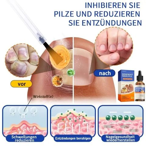 Tinh chất Dưỡng móng tay dài cứng Nails Repair Serum cứng móng, phục hồi móng Mỏng, Chẻ, Serum Nấm Móng 50ML