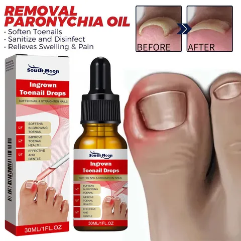 Serum nấm móng tay chân dưỡng cứng dài móng 