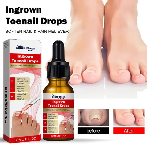 Serum nấm móng tay chân dưỡng cứng dài móng 